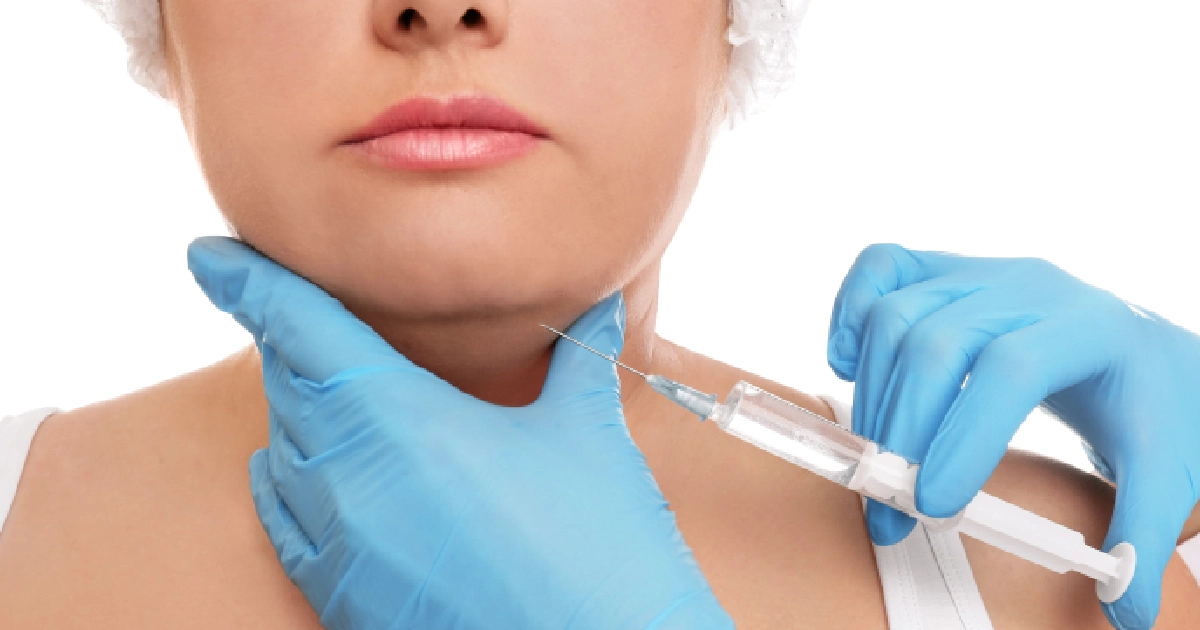 Close-up of a person receiving a Kybella injection in the chin in Memphis, TN, with a gloved professional holding the syringe.