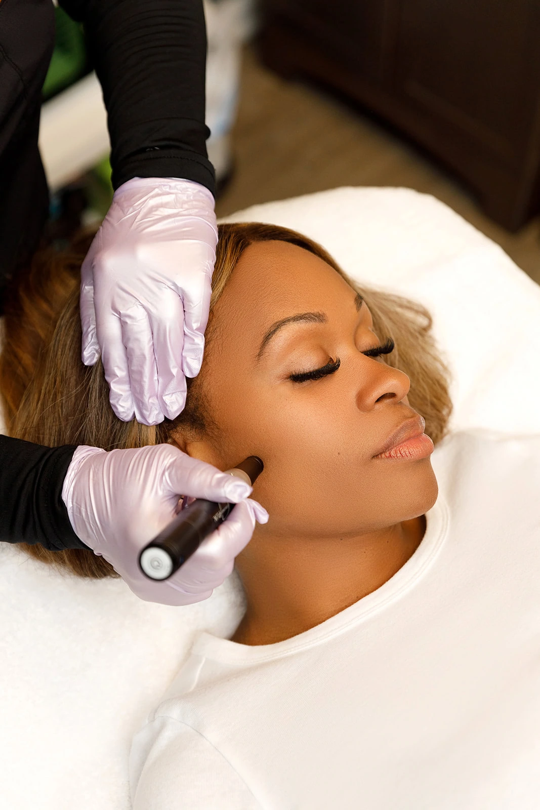 Smooth, rejuvenated skin after a microneedling treatment session