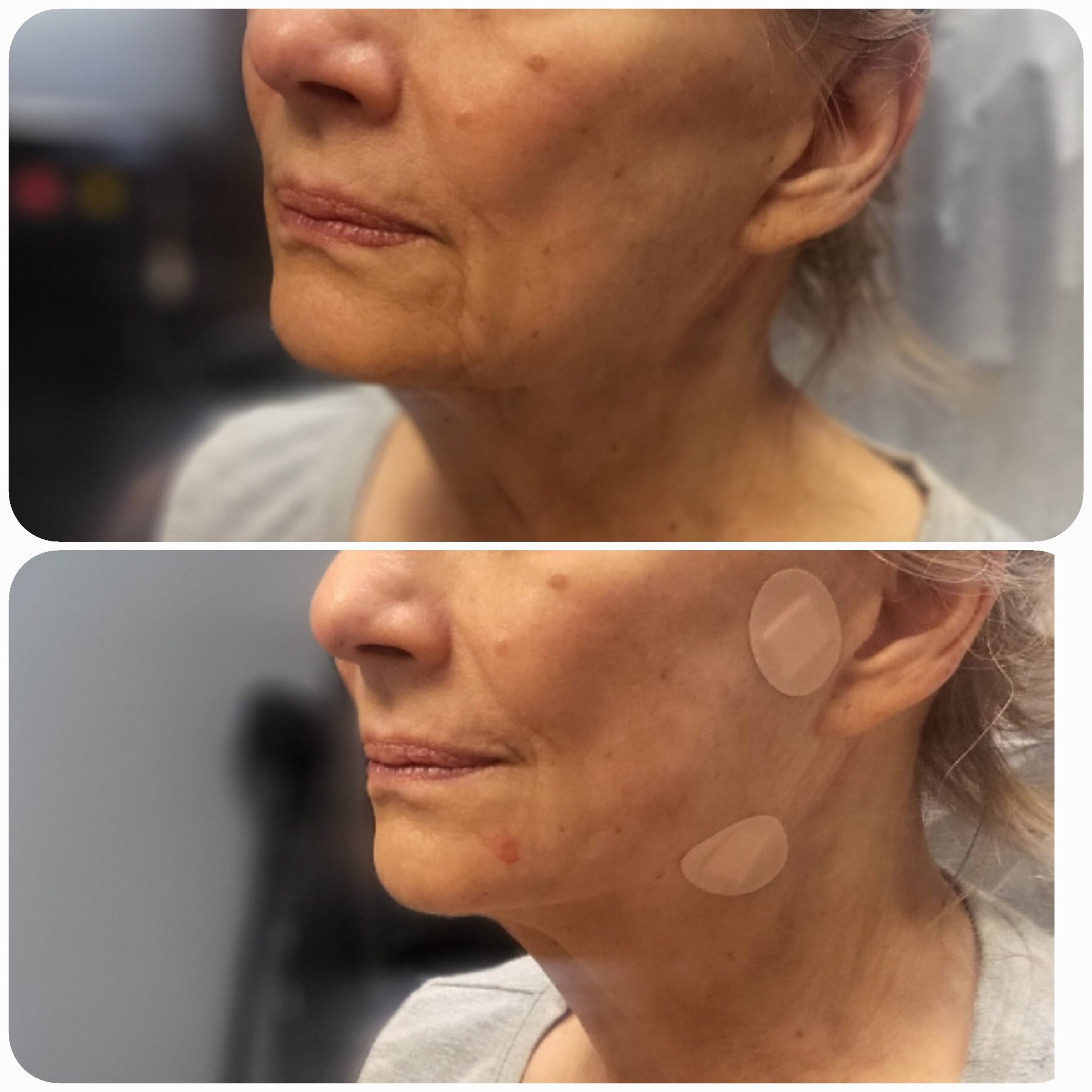 IV Therapy Before and After (1)