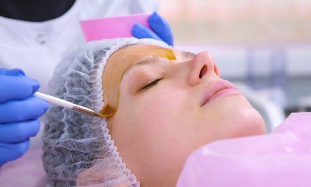 Does Chemical Peeling Lighten The Skin