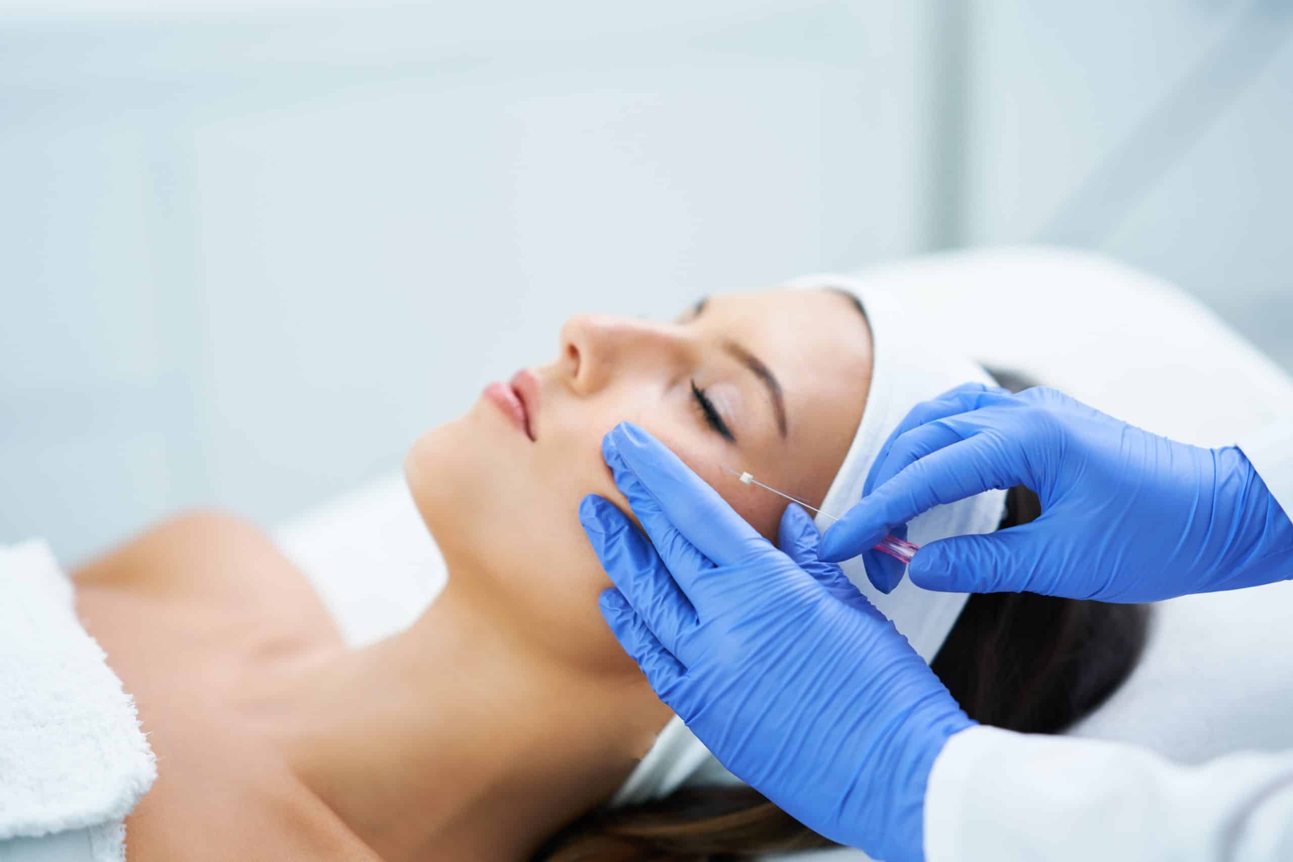 What To Expect During A PDO Thread Lift Procedure