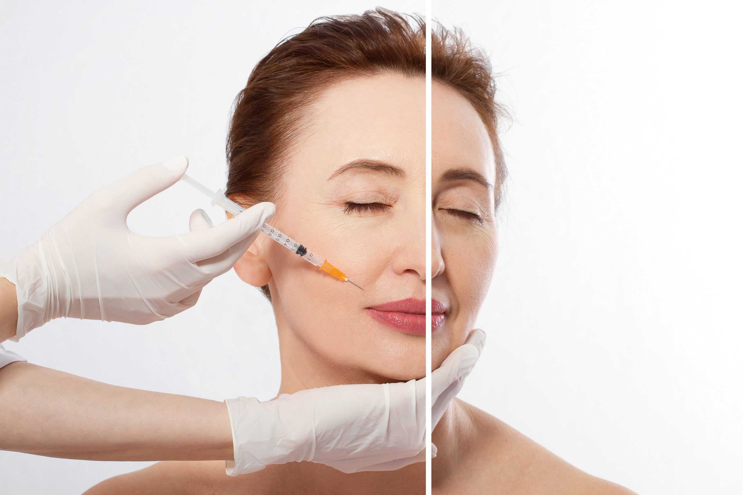 Neuromodulators by Royalty Wellness Medspa in Memphis TN